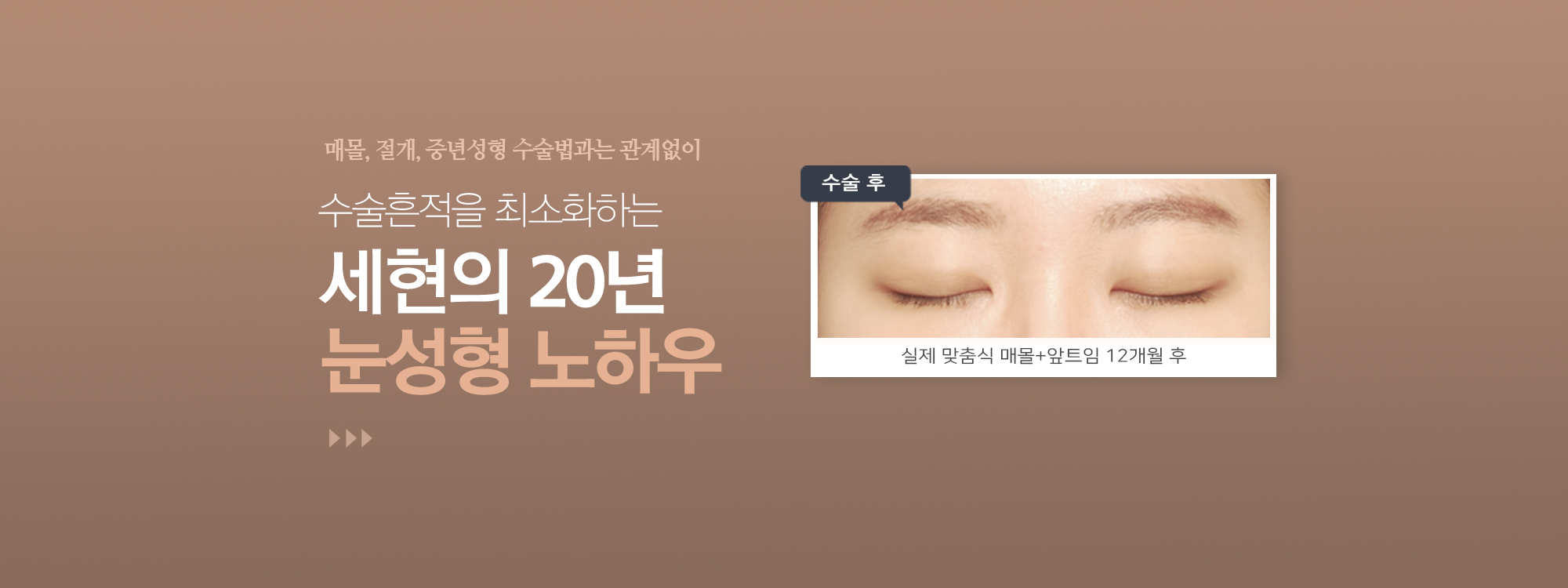 비주얼 이미지