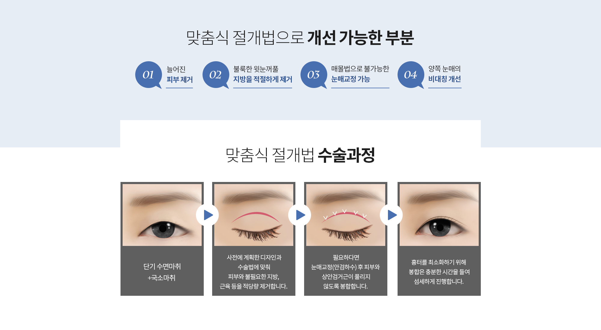 맞춤식 절개법으로 개선 가능한 부분