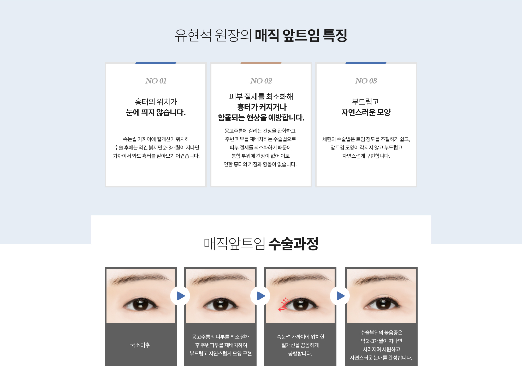 유현석 원장의 
		매직 앞트임 특징 
		01 흉터의 위치가 눈에 띄지 않습니다. 
		속눈썹 가까이에 절개선이 위치해 
		수술 후에는 약간 붉지만 2~3개월이 지나면
		가까이서 봐도 흉터를 알아보기 어렵습니다. 

		02 피부 절제를 최소화해 흉터가 커지거나 함몰되는 현상을 예방합니다. 
		몽고주름에 걸리는 긴장을 완화하고 
		주변 피부를 재배치하는 수술법으로 피부 절제를 최소화하기 때문에 봉합 부위에 긴장이 없어 이로 인한 흉터의 커짐과 함몰이 없습니다. 

		03 부드럽고 자연스러운 모양
		세현의 수술법은 트임 정도를 조절하기 쉽고, 
		앞트임 모양이 각지지 않고 부드럽고 자연스럽게 구현합니다.