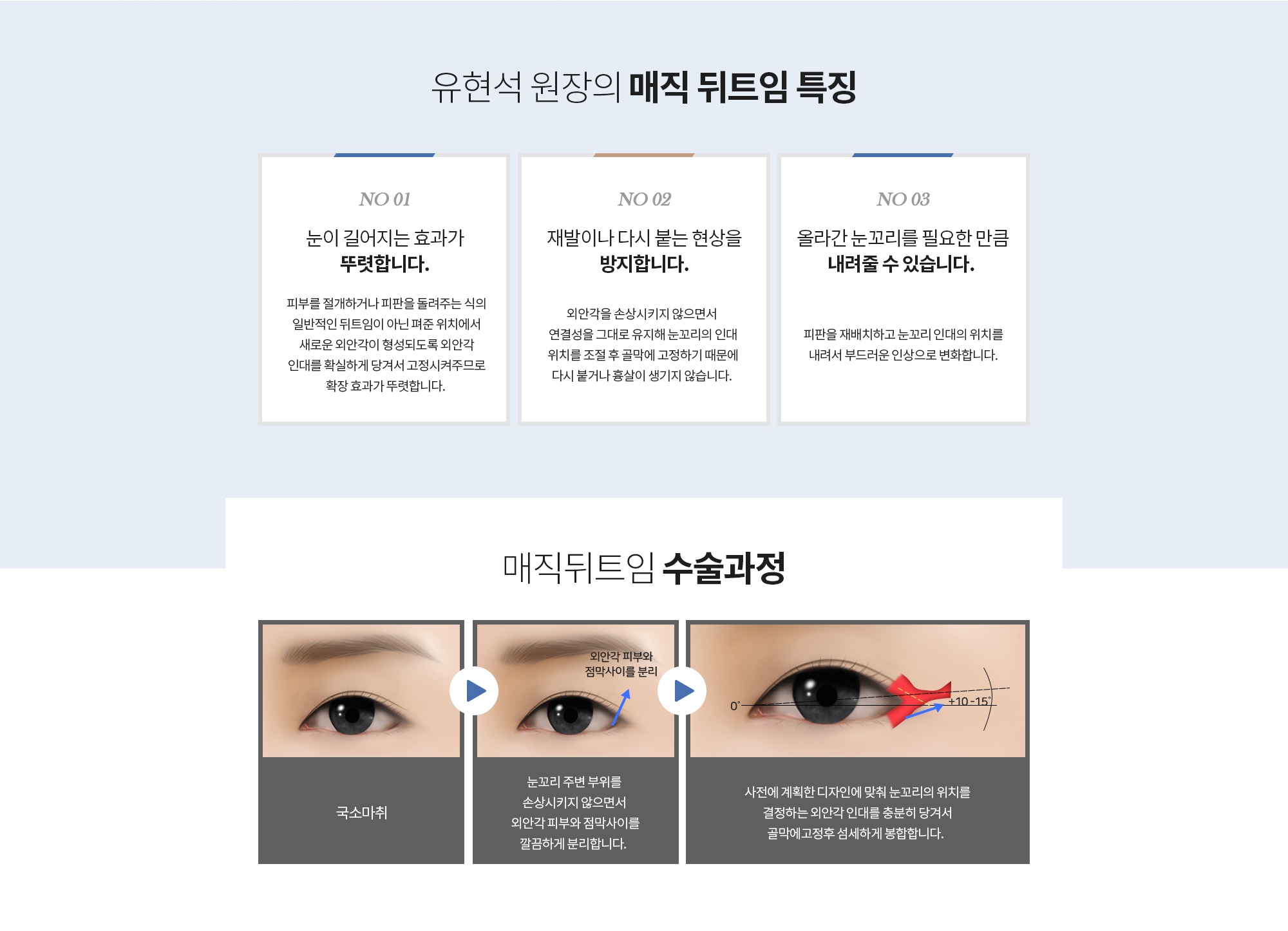 유현석 원장의 매직 뒤트임 특징
		눈이 길어지는 효과가 뚜렷합니다. 
		피부를 절개하거나 피판을 돌려주는 식의 일반적인 뒤트임이 아닌 펴준 위치에서 새로운 외안각이 형성되도록 외안각 인대를 확실하게 당겨서 고정시켜주므로 확장 효과가 뚜렷합니다. 

		재발이나 다시 붙는 현상을 방지합니다. 
		외안각을 손상시키지 않으면서 
		연결성을 그대로 유지해 눈꼬리의 인대 위치를 조절 후 골막에 고정하기 때문에
		다시 붙거나 흉살이 생기지 않습니다. 

		올라간 눈꼬리를 필요한 만큼 내려줄 수 있습니다. 
		피판을 재배치하고 눈꼬리 인대의 위치를 
		내려서 부드러운 인상으로 변화합니다. 

		매직뒤트임 수술과정
		국소마취 
		눈꼬리 주변 부위를 손상시키지 않으면서 외안각 피부와 점막사이를 깔끔하게 분리합니다. 
		사전에 계획한 디자인에 맞춰 눈꼬리의 위치를 결정하는 외안각 인대를 충분히 당겨서 골막에 고정후 섬세하게 봉합합니다.