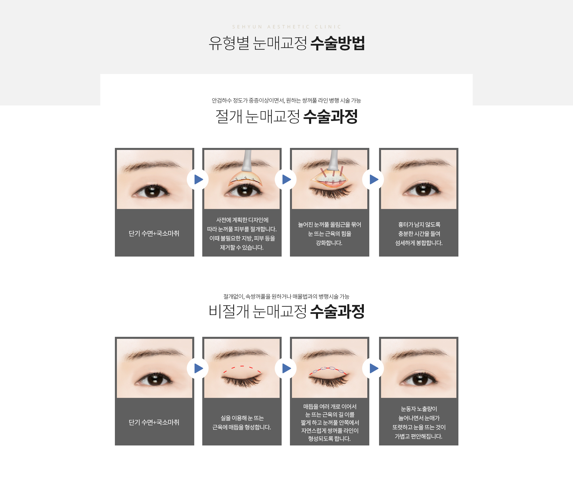 유형별 눈매교정 수술방법
		절개 눈매교정 수술과정
		단기 수면+국소마취 
		사전에 계획한 디자인에 따라 눈꺼풀 피부를 절개합니다. 
		이때 불필요한 지방, 피부 등을 제거할 수 있습니다. 
		늘어진 눈꺼풀 올림근을 묶어 눈 뜨는 근육의 힘을 강화합니다. 
		흉터가 남지 않도록 충분한 시간을 들여 섬세하게 봉합합니다. 

		비절개 눈매교정 수술과정
		단기 수면+국소마취 
		실을 이용해 눈 뜨는 근육에 매듭을 형성합니다. 
		매듭을 여러 개로 이어서 눈 뜨는 근육의 길이를 짧게 하고 눈꺼풀 안쪽에서 자연스럽게 쌍꺼풀 라인이 형성되도록 합니다. 
		눈동자 노출량이 늘어나면서 눈매가 또렷하고 눈을 뜨는 것이 가볍고 편안해집니다.