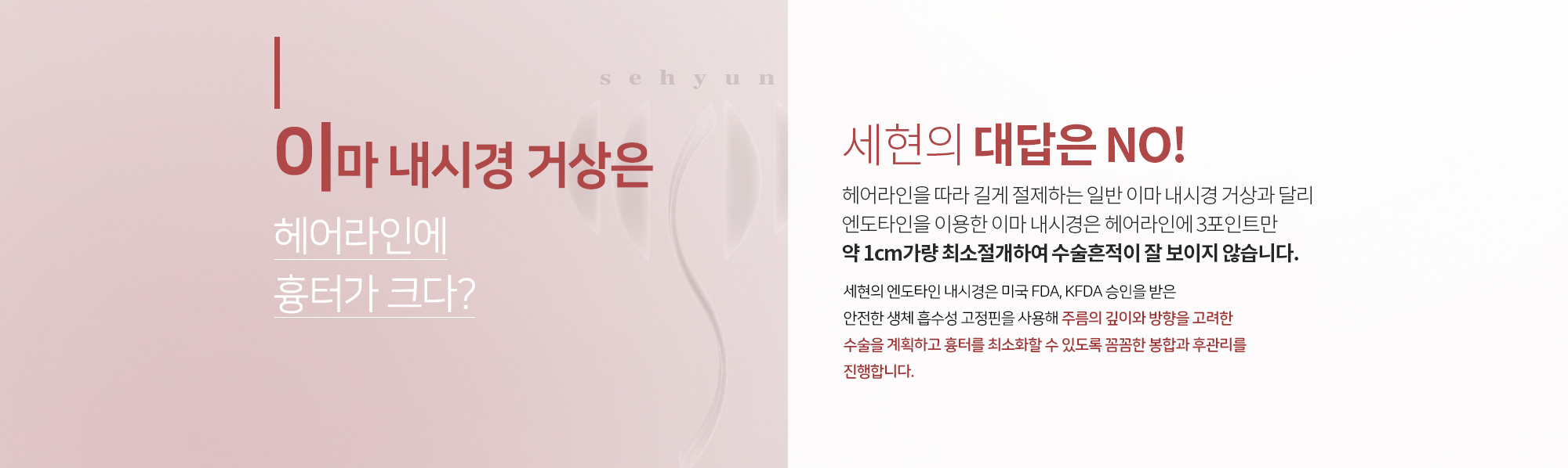 이마 내시경 거상은 헤어라인에 흉터 크다?
		세현의 대답은 NO
		헤어라인을 따라 길게 절제하는 일반 이마 내시경 거상과 달리
		엔도타인을 이용한 이마 내시경은 헤어라인에 3포인트만 약 1cm가량 
		최소절개하여 수술흔적이 잘 보이지 않습니다. 


		세현의 엔도타인 내시경은 미국 FDA, KFDA 승인을 받은 
		안전한 생체 흡수성 고정핀을 사용해 주름의 깊이와 방향을 고려한 
		수술을 계획하고 흉터를 최소화할 수 있도록 꼼꼼한 봉합과 후관리를 진행합니다.