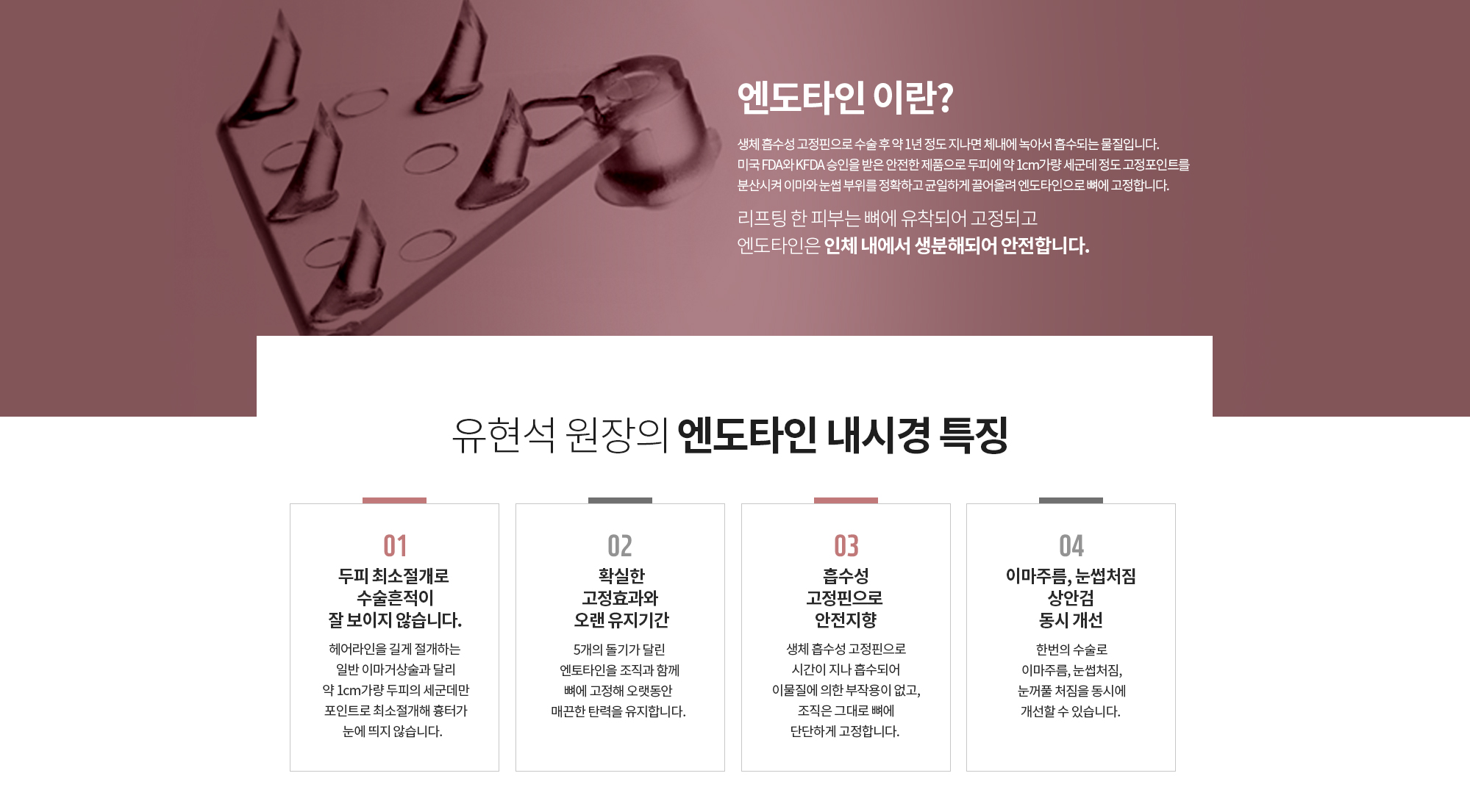 엔도타인 이란?
		생체 흡수성 고정핀으로 수술 후 약 1년 정도 지나면 체내에 녹아서 흡수되는 물질입니다.
		미국 FDA와 KFDA 승인을 받은 안전한 제품으로 두피에 약 1cm가량 세군데 정도 고정포인트를 분산시켜 이마와 눈썹 부위를 정확하고 균일하게 끌어올려 엔도타인으로 뼈에 고정합니다.   

		리프팅 한 피부는 뼈에 유착되어 고정되고 엔도타인은 인체 내에서 생분해되어 안전합니다.