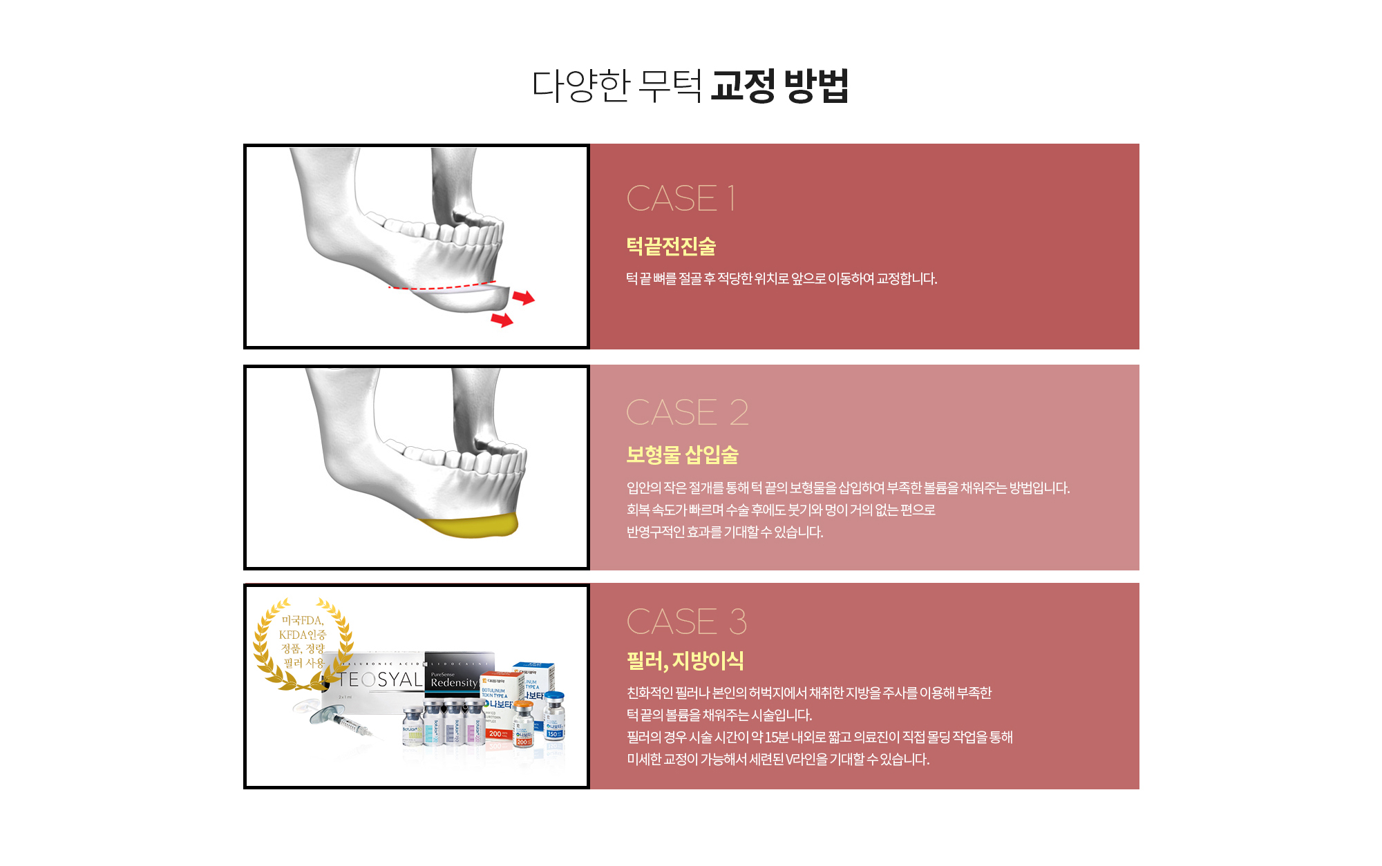 다양한 무턱 교정 방법
		1. 턱끝전진술
		턱 끝 뼈를 절골 후 적당한 위치로 앞으로 이동하여 교정합니다. 

		2. 보형물 삽입술
		입안의 작은 절개를 통해 턱 끝의 보형물을 삽입하여 부족한 볼륨을 채워주는 방법입니다. 회복 속도가 빠르며 수술 후에도 붓기와 멍이 거의 없는 편으로 반영구적인 효과를 기대할 수 있습니다. 

		3. 필러, 지방이식
		체 친화적인 필러나 본인의 허벅지에서 채취한 지방을 주사를 이용해 부족한 턱 끝의 볼륨을 채워주는 시술입니다. 

		필러의 경우 시술 시간이 약 15분 내외로 짧고 의료진이 직접 몰딩 작업을 통해 미세한 교정이 가능해서 세련된 V라인을 기대할 수 있습니다.