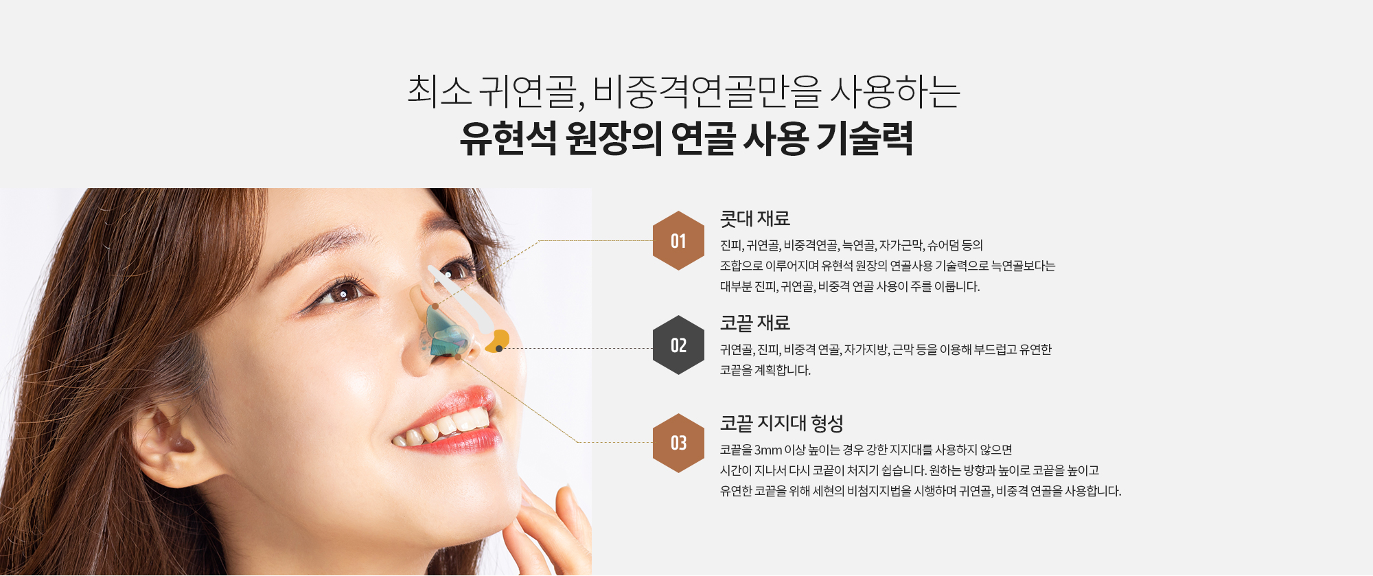 최소 귀연골, 비중격연골만을 사용하는 
		유현석 원장의 연골 사용 기술력 
		콧대 재료
		진피, 귀연골, 비중격연골, 늑연골, 자가근막, 슈어덤 등의 조합으로 이루어지며 유현석 원장의 연골사용 기술력으로 늑연골보다는 대부분 진피, 귀연골, 비중격 연골 사용이 주를 이룹니다.
		코끝 재료
		귀연골, 진피, 비중격 연골, 자가지방, 근막 등을 이용해 부드럽고 유연한 코끝을 계획합니다. 
		코끝 지지대 형성
		코끝을 3mm 이상 높이는 경우 강한 지지대를 사용하지 않으면 시간이 지나서 다시 코끝이 처지기 쉽습니다. 원하는 방향과 높이로 코끝을 높이고 유연한 코끝을 위해 세현의 비첨지지법을 시행하며 귀연골, 비중격 연골을 사용합니다.
