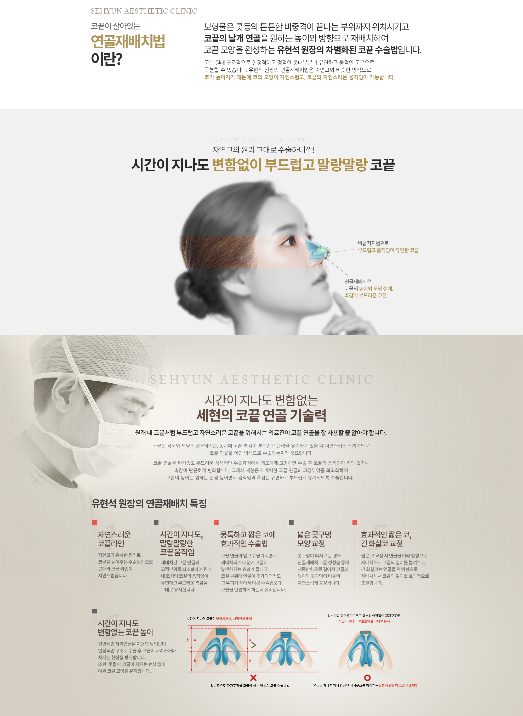코끝이 살아있는 연골재배치법이란? 
					연골재배치법은 보형물은 콧등의 튼튼한 비중격이 끝나는 부위까지 위치시키고 
					코끝의 날개 연골을 원하는 높이와 방향으로 재배치하여 코끝 모양을 완성하는 
					세현 유현석 원장의 차별화된 코끝 성형 수술법입니다. 

					코는 구조적으로 안정적으로 정적인 콧대 부분과 
					유연하고 동적인 아랫부분인 코끝으로 구분할 수 있습니다. 

					세현의 연골재배치법은 콧대 부분과 코끝 부분으로 구분하여
					자연코와 비슷한 방식으로 코가 높아지기 때문에 
					코의 모양이 자연스러우면서 코끝의 자연스러운 움직임이 가능합니다. 

					원래 내 코끝처럼 
					부드럽고 자연스러운 코끝을 위해서는 
					코끝 연골을 잘 사용할 줄 알아야 합니다. 
					코끝은 각도와 모양도 중요하지만, 무엇보다 코끝 촉감이 원래 내 코처럼 부드럽고 탄력을 유지하고 있을 때 자연스럽게 느껴집니다. 
					이 때문에 코끝 연골을 어떤 방식으로 수술하는지가 중요합니다. 

					본연의 코끝 연골은 탄력 있고 부드러운 상태지만 수술과정에서 과도하게 고정하면 수술 후 코끝의 움직임이 거의 없거나, 촉감이 단단하게 
					변화합니다. 그래서 세현은 재배치한 코끝 연골의 고정부위를 최소화하여 코끝의 높이는 원하는 만큼 높이면서 움직임과 촉감은 유연하고 
					부드럽게 유지되도록 수술합니다.