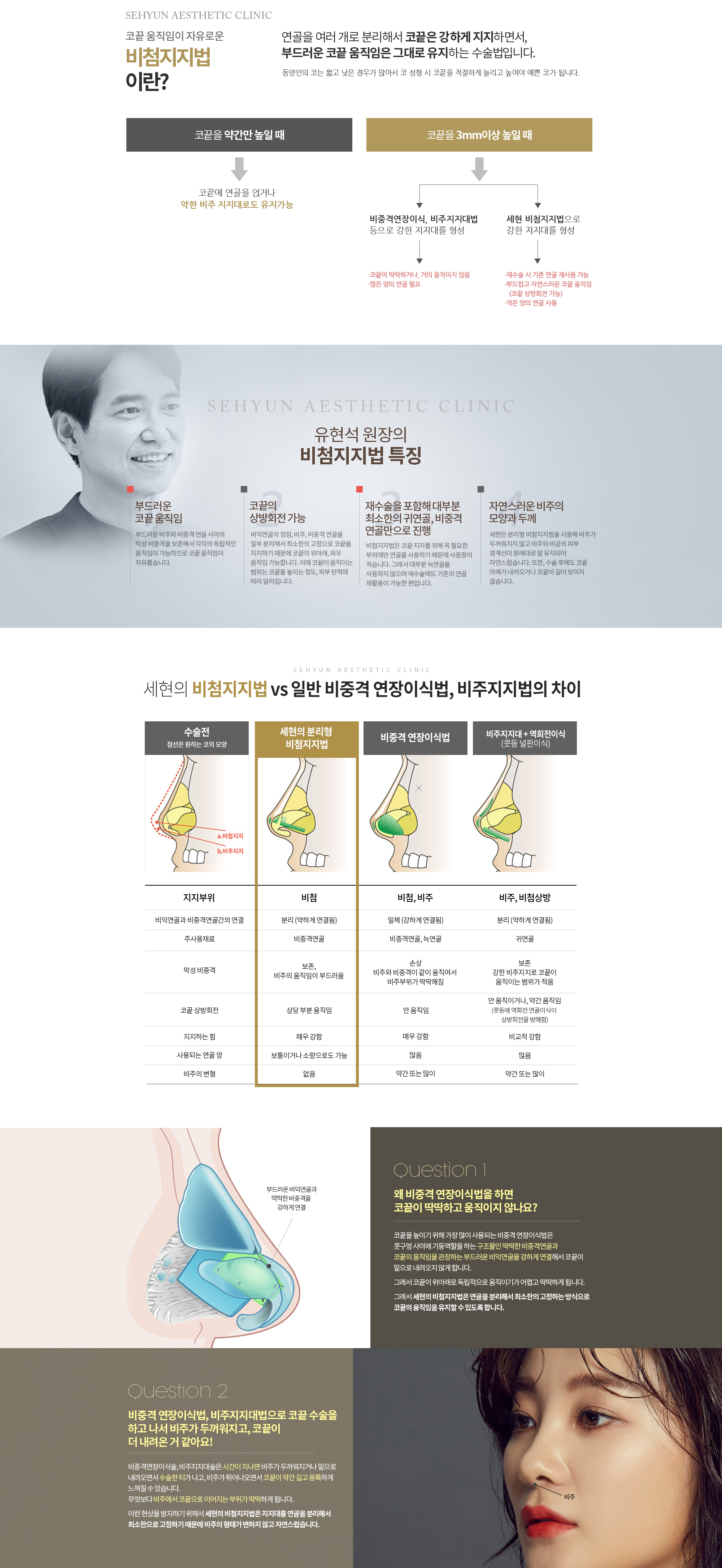 코끝 움직임이 자유로운 비첨지지법이란? 
					코끝은 강하게 지지하면서, 본연의 부드러운 코끝의 움직임은 그대로 유지하는 연골을 여러 개로 분리해서 사용하는 유현석 원장의 수술법입니다. 

					동양인의 코는 짧고 낮은 경우가 많아서 코성형 시 코끝을 적절하게 늘리고 높여주어야 예쁜 코가 됩니다. 

					코를 약간만 높일 때에는 코끝에 연골을 얹어주거나 약한 비주 지지대만으로도 충분하지만, 코끝을 3mm 이상 높일 때 강한 지지대를 사용하지 않으면, 시간이 지날수록 코끝이 내려오거나 처지는 현상이 발생합니다. 

					이 때문에 코끝을 지지하는 방법으로 주로 비중격 연장 이식, 비주지지대법이 사용되는데 이러한 방법은 지지하는 힘을 강하지만, 많은 양의 연골이 있어야 하고 시간이 지나면 코끝이 딱딱하고, 거의 움직이지 않게 됩니다. 

					원래 코끝은 움직임이 자유롭고 부드러운 부위입니다. 
					유현석 원장의 비첨지지법은 시간이 지나도 코끝이 내려오지 않으면서
					코끝의 상방 회전이 가능하고 자연스럽습니다.