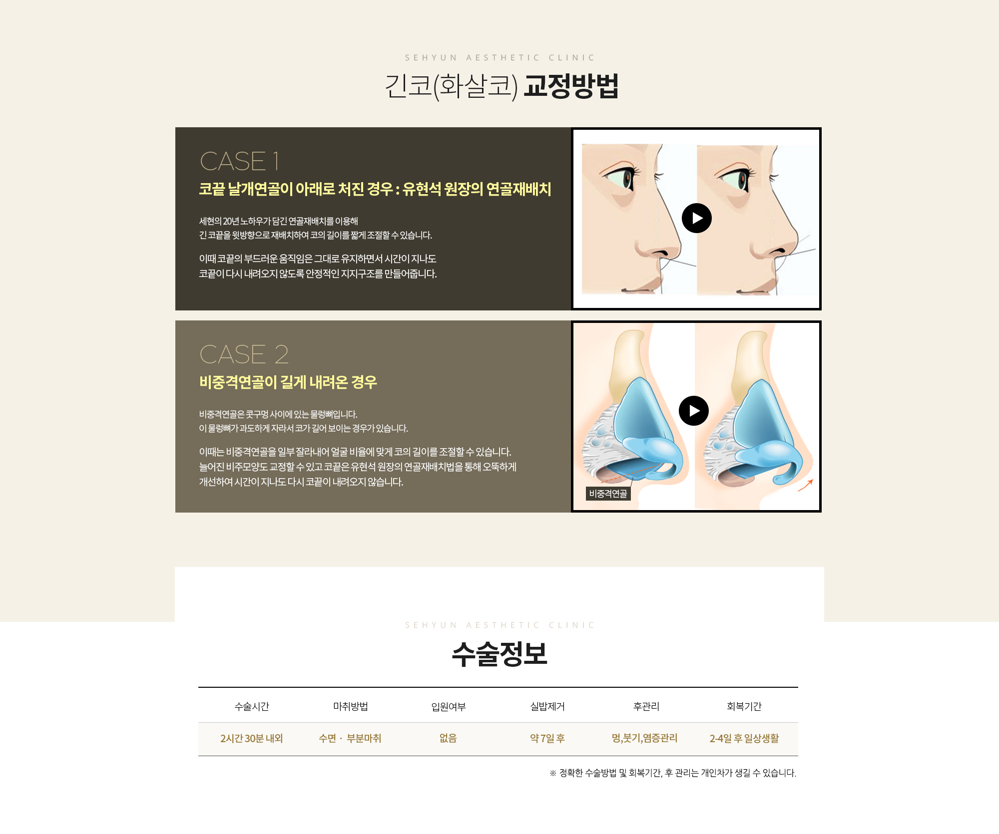 CASE 1. 코끝 날개연골이 아래로 처진 경우 
		날개 연골이 입술 쪽으로 처져 있는 경우 유현석 원장의 연골재배치법을 이용해 
		날개 연골을 위 방향으로 회전시켜 줍니다. 

		이때 코끝의 부드러운 움직임은 그대로 유지하면서 시간이 지나도 코끝이 다시 내려오지 않도록 안정적인 지지구조를 만들어줍니다. 

		CASE 2. 비중격연골이 길게 내려온 경우 
		비중격연골은 콧구멍 사이에 있는 물렁뼈입니다. 
		이 물렁뼈가 과도하게 자라서 코가 길어 보이는 경우가 있습니다. 

		이때는 비중격연골을 일부 잘라내어 얼굴 비율에 맞게 
		코의 길이를 조절할 수 있습니다. 늘어진 비주모양도 교정할 수 있고 
		코끝은 유현석 원장의 연골재배치법을 통해 오뚝하게 개선하여 시간이 지나도 
		다시 코끝이 내려오지 않습니다.