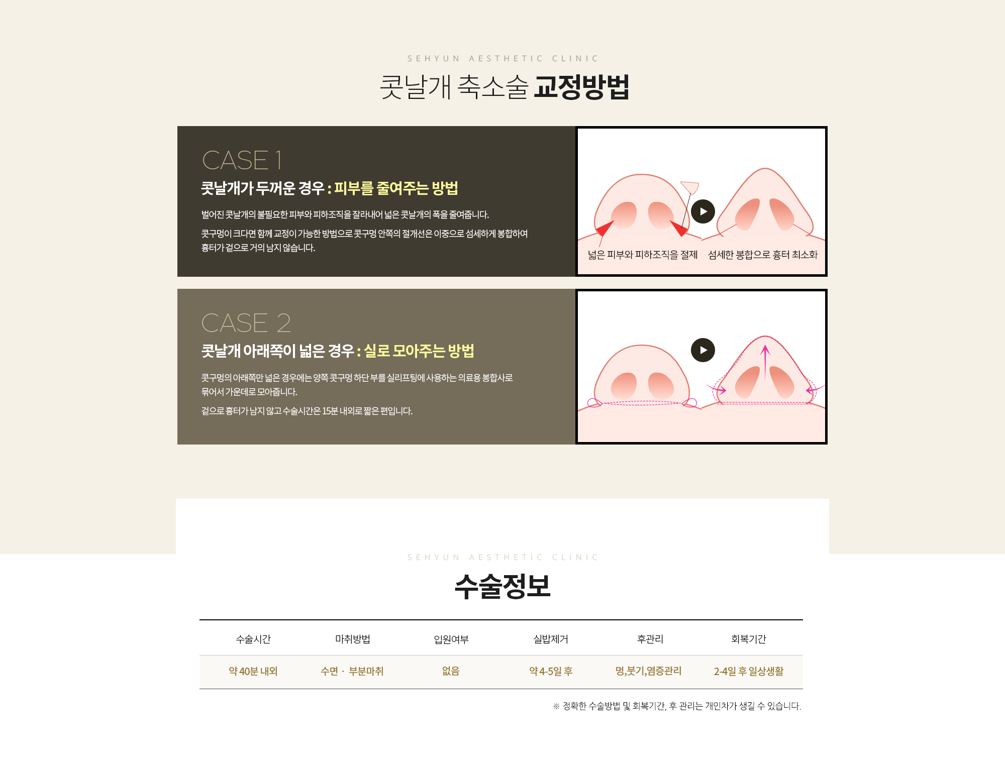 콧날개가 두꺼운 경우
		: 피부를 줄여주는 방법
		벌어진 콧날개의 불필요한 피부와 피하조직을 잘라내어
		넓은 콧날개의 폭을 줄여줍니다. 

		콧구멍이 크다면 함께 교정이 가능한 방법으로 
		콧구멍 안쪽의 절개선은 이중으로 섬세하게 봉합하여 
		흉터가 겉으로 거의 남지 않습니다. 

		콧날개 아래쪽이 넓은 경우 
		: 실로 모아주는 방법
		콧구멍의 아래쪽만 넓은 경우에는 양쪽 콧구멍 하단 부를
		실리프팅에 사용하는 의료용 봉합사로 묶어서 가운데로 모아줍니다. 

		겉으로 흉터가 남지 않고 수술시간은 15분 내외로 짧은 편입니다.