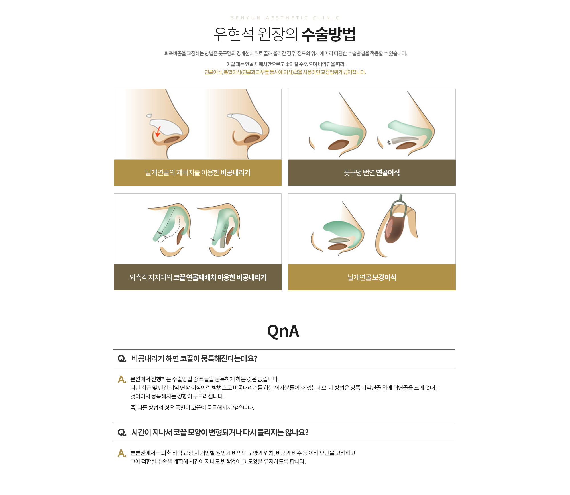 Q. 비공내리기 하면 코끝이 뭉툭해진다는데요?
		본원에서 진행하는 수술방법 중 코끝을 뭉툭하게 하는 것은 없습니다. 다만 최근 몇 년간 비익 연장 이식이란 방법으로 비공내리기를 하는 의사분들이 꽤 있는데요. 이 방법은 양쪽 비익연골 위에 귀연골을 크게 덧대는 것이어서 뭉툭해지는 경향이 두드러집니다. 

		즉, 다른 방법의 경우 특별히 코끝이 뭉특해지지 않습니다.   

		Q. 시간이 지나서 코끝 모양이 변형되거나 다시 들리지는 않나요? 
		A. 본본원에서는 퇴축 비익 교정 시 개인별 원인과 비익의 모양과 위치, 비공과 비주 등 여러 요인을 고려하고 그에 적합한 수술을 계획해 시간이 지나도 변함없이 그 모양을 유지하도록 합니다.